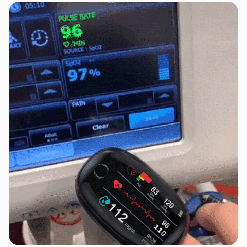 🔥تخفيضات هائلة ٥٠٪🔥 جهاز قياس نسبة السكر في الدم غير جراحي